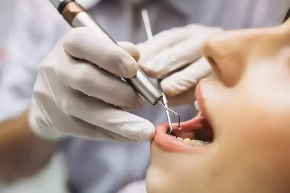 Estética Dental