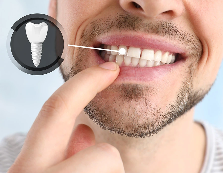 Prothèses dentaires AKDENT